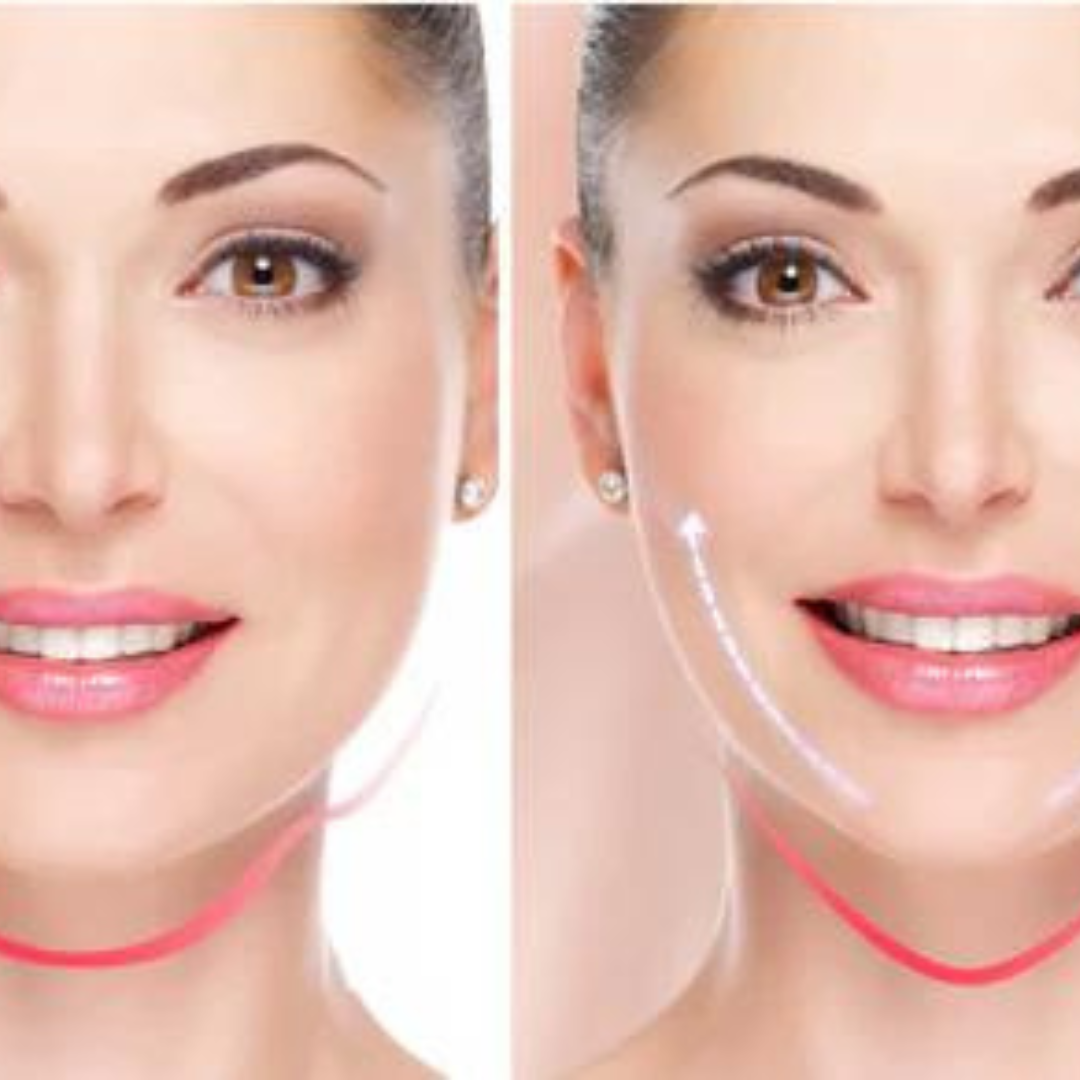 Lifting face™ Parche de estiramiento facial