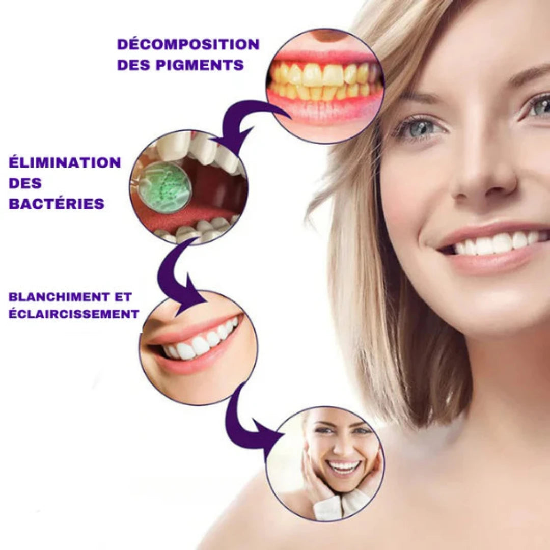 BLANQUEADOR DENTAL - PASTA DE DIENTES MORADA - SMILE EASE