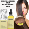 Carvenchy-Prevención de la caída del cabello